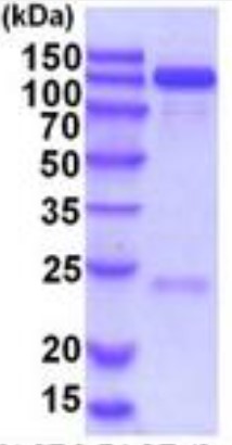 SDS-PAGE (HK1-40H).jpg